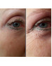 WONDERLIFT SERUM 15ML - CARISSA MORELLO